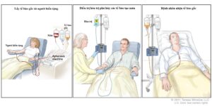 ghép tế bào gốc điều trị ung thư