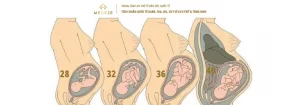 Vì sao mang thai 3 tháng đầu rất nguy hiểm? 5 Điều Nên và Không nên