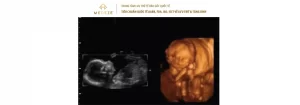 Bà bầu cần lưu ý những vấn đề gì khi mang thai tháng thứ bảy?