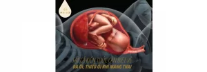 Đa ối, thiểu ối trong thai kỳ: Tất cả kiến thức mẹ bầu cần nắm rõ