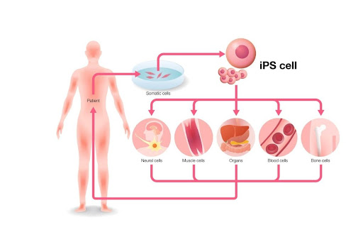 Tế bào gốc đa năng cảm ứng (iPSC) và những tiềm năng ứng dụng trong y học