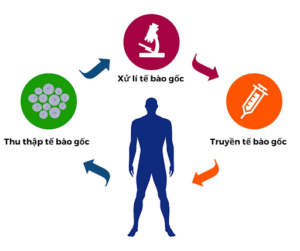 Giá làm tế bào gốc tự thân là bao nhiêu?