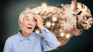 Liệu pháp điều trị bệnh Alzheimer bằng tế bào gốc